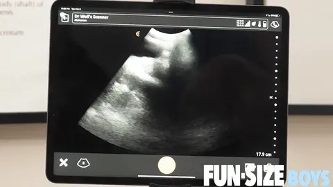 Échographie anale — GRANT Épisode 1