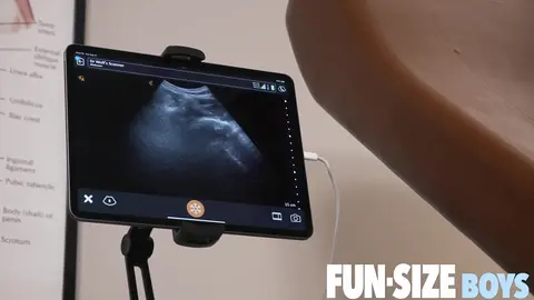 MAX Episode 3 - Anal Ultrasound